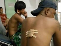 Warga yang terluka kena tembakan. Foto: FPR