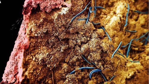 Monhystrella parvella, maklhluk hidup di lingkungan terdalam yang pernah ditemukan. Kredit foto: Gaetan Borgonie et al