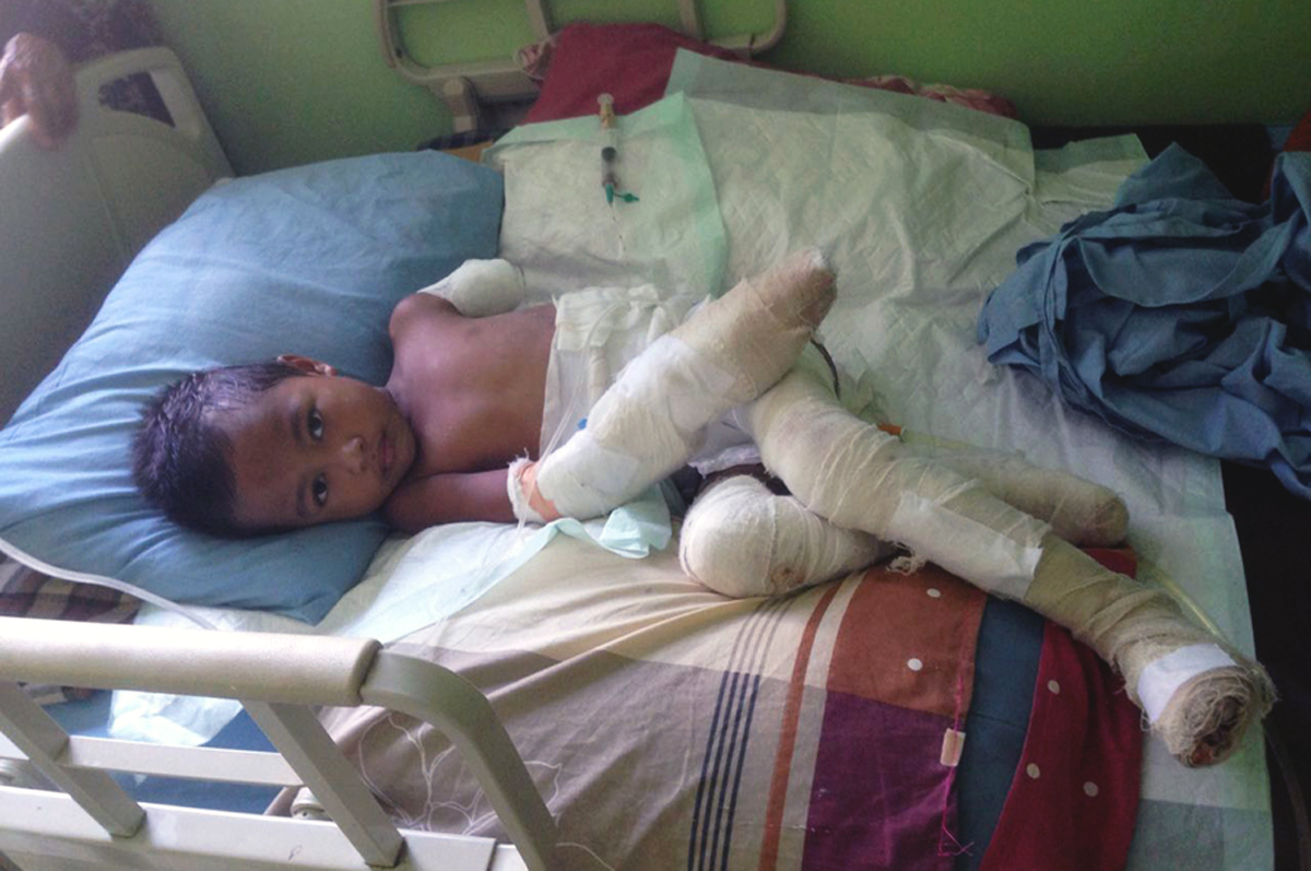 Muhammad Arham yang mengalami luka serius akibat terjatuh di gundukan batubara menyala. Tangis pilu mengiringi kepergiannya. Foto: Jatam Kaltim