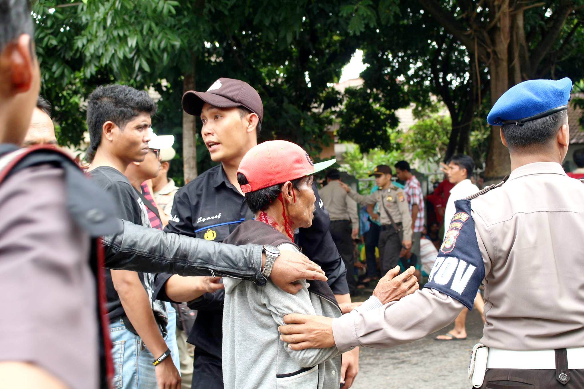 Seorang nelayan yang menjadi korban kekerasan polisi dalam aksi unjuk rasa pada 27 Januari 2016 yang menolak rencana pengerukan pasir laut di pesisir utara Lombok Timur, NTB. Foto : Safprada Rha