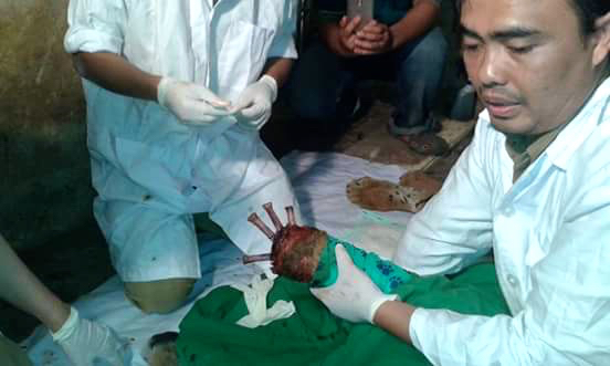 Salah seorang tim Dokter hewan memperlihatkan bagian kaki depan harimau sumatera yang baru saja menjalani operasi amputasi lengan kanan bagian depan (Metacarpal dextra). Tindakan ini terpaksa dilakukan karena kaki Harimau Sumatera tersebut mengalami infeksi akibat terjerat perangkap warga jenis sling baja di Taratak Mandeh, Kabupaten Pesisir Selatan beberapa waktu lalu. Foto: Vinolia