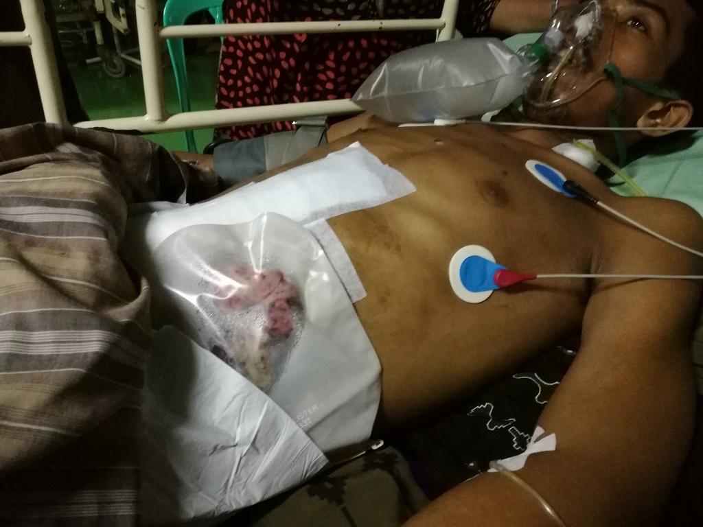 Saddam, nelayan korban penembakan yang diduga dilakukan oleh polisi hutan (jagawana) Taman Nasional Takabonerate, Selayar, Sulawesi Selatan, mengalami luka tembak tembus dari belakang ke depan mengenai ususnya. Dalam dua kali operasi sebelumnya sempat terjadi infeksi sehingga harus dirujuk ke RS Pelamonia Makassar yang memiliki fasilitas operasi yang lebih baik. Foto: Wahyu Chandra