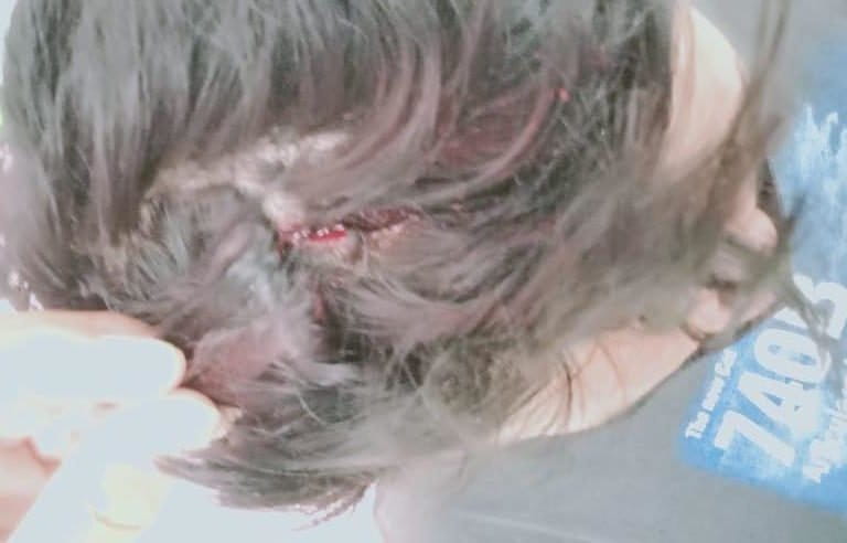 Luka di kepala warga diduga terkena lemparan batu. Foto: dokumen AMAN