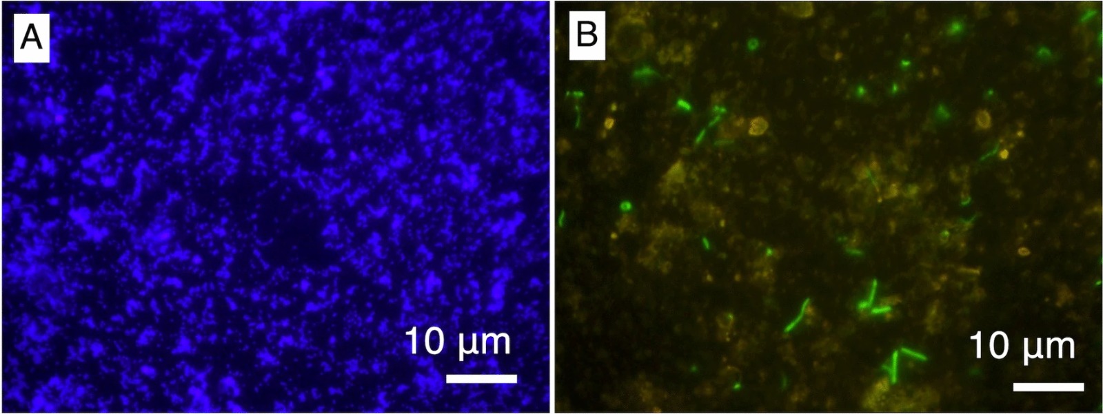 Pemeriksaan mikroskopis dari sampel cairan pengeboran. (A) Gambar perbesaran 1000 kali dari mikrosfer fluoresen dan (B) sel mikroba yang dipulas dengan SYBR Green I | Suzuki, Y., Webb, S.J., Kouduka, M. et al. Subsurface Microbial Colonization at Mineral-Filled Veins in 2-Billion-Year-Old Mafic Rock from the Bushveld Igneous Complex, South Africa. Microb Ecol 87, 116 (2024). https://doi.org/10.1007/s00248-024-02434-8