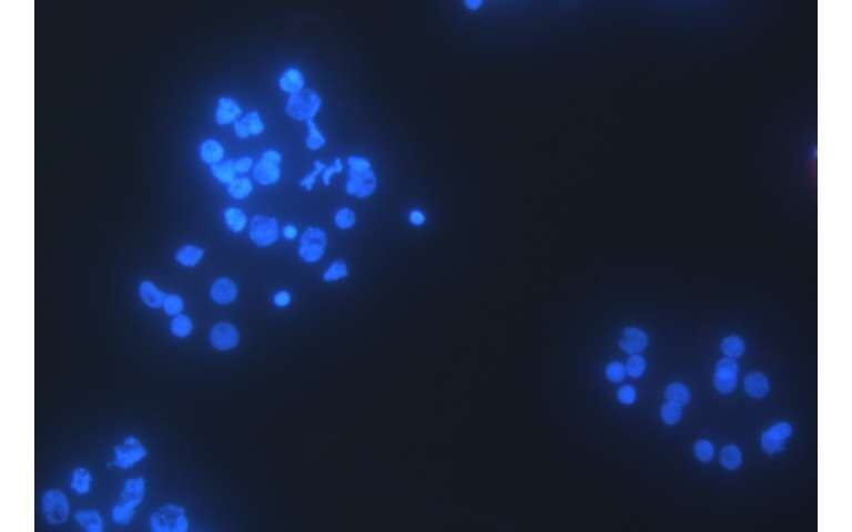Foto fluoresensi sel Henneguya salminicola: lingkaran biru besar menunjukkan DNA inti, sedangkan tidak terlihat titik-titik kecil yang menandakan mitokondria—karena memang tidak ada | Foto oleh: Stephen Douglas Atkinson