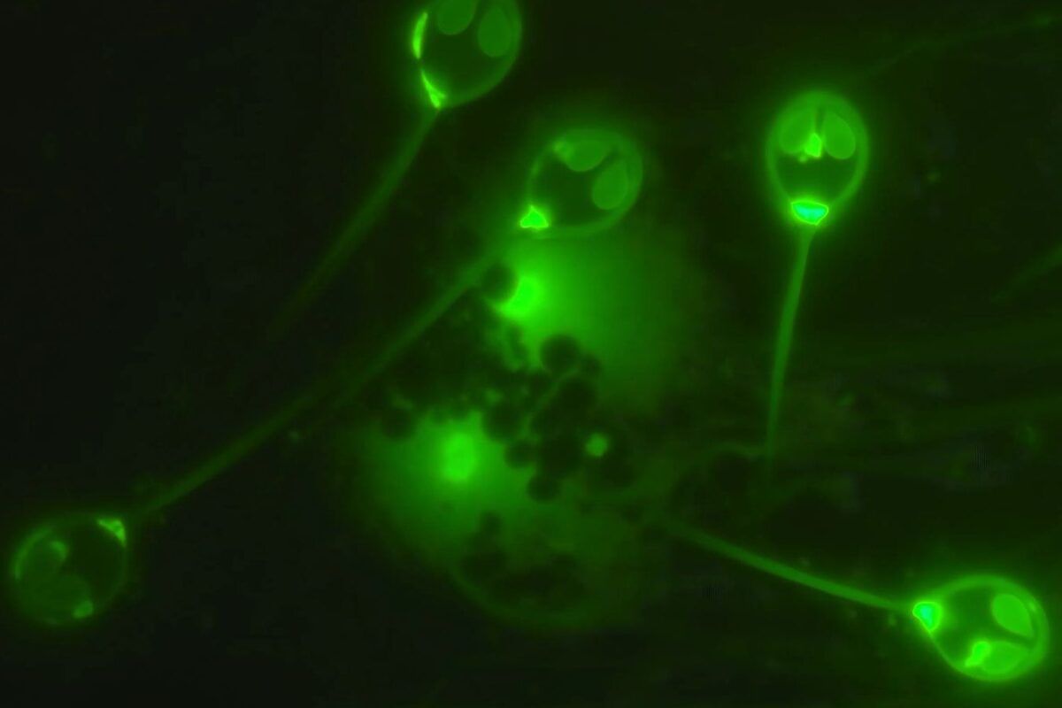 Spora mikroskopis dari parasit Henneguya salminicola, satu-satunya hewan multiseluler yang diketahui hidup tanpa oksigen. | Foto oleh: Stephen Douglas Atkinson)