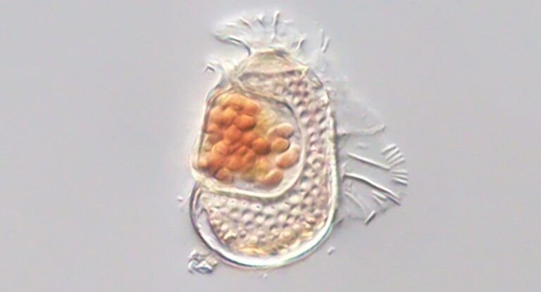 Sel plankton dinoflagellata tempat Sukunaarchaeum mirabile ditemukan. Mikroba ini hidup menumpang dan hanya mempertahankan fungsi dasar replikasi, membuatnya lebih mirip virus daripada sel mandiri. Sumber: Takuro Nakayama/University of Tsukuba