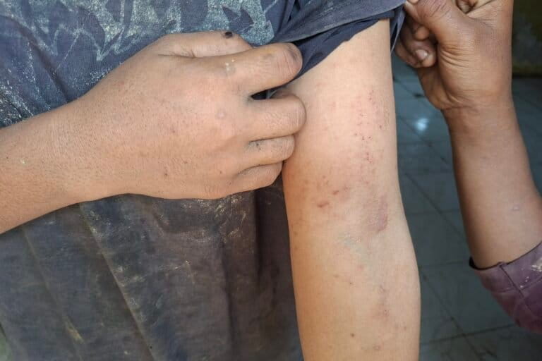 Cemaran Abu PLTU Tenayan Raya Resahkan Warga Pekanbaru